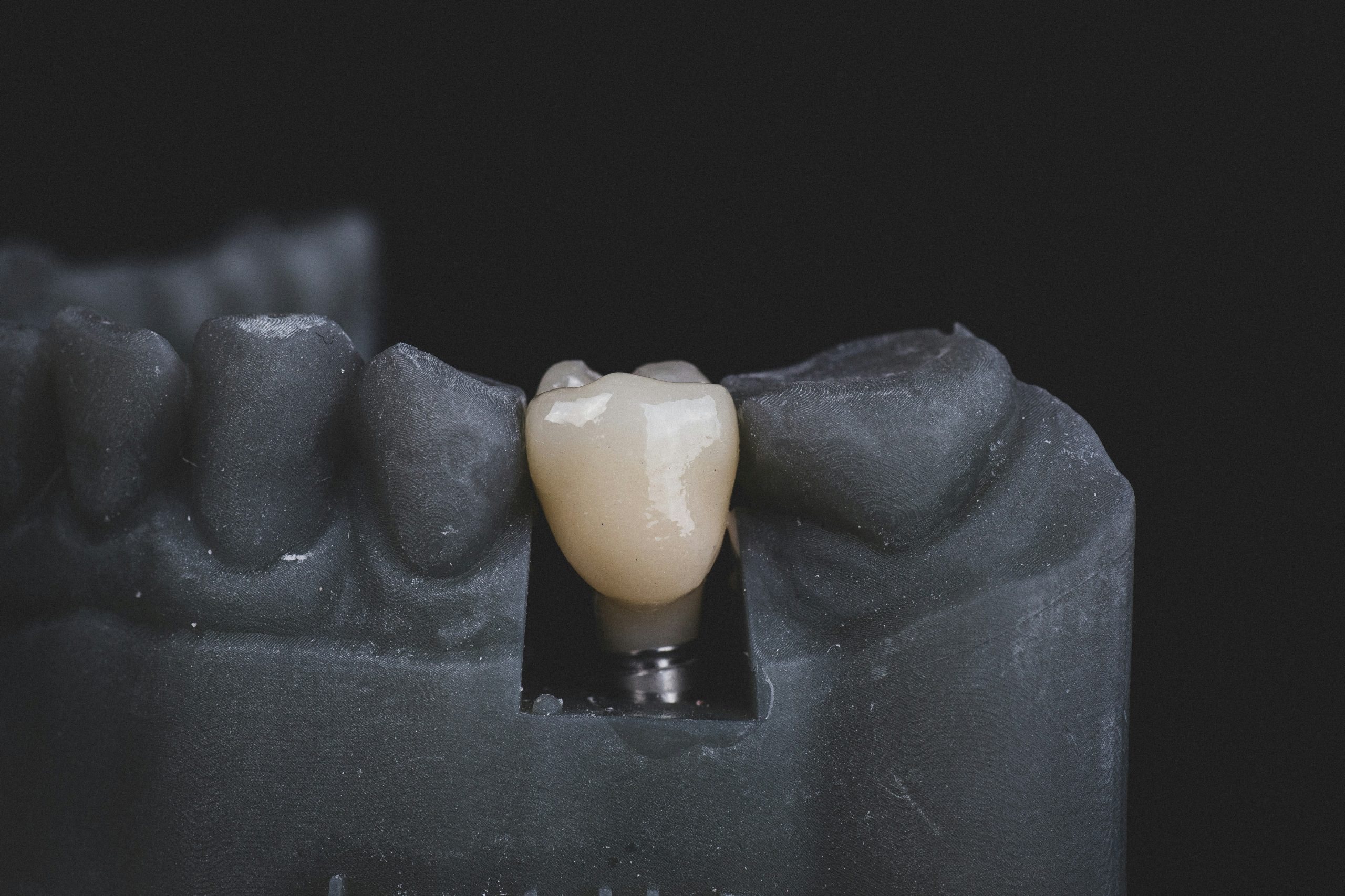 Bogdan condr q1klbswf70y unsplash Young Leaders 4 common myths about dental implants corrected by experts