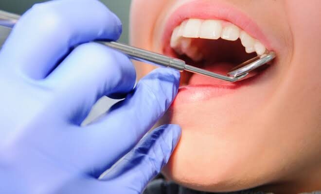 4 Preventive Services Every Pediatric Dentist Recommends