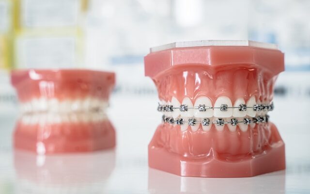 Tracking Dental Wear Patterns To Improve Bite Alignment And Comfort