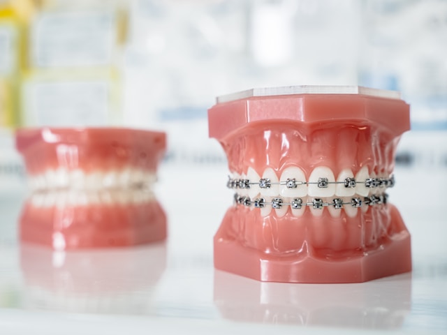 Katarzyna zygnerska p8ernbht m unsplash 1 Young Leaders tracking dental wear patterns to improve bite alignment and comfort